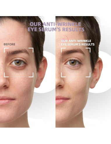 Suero para Ojos RWT con 5% Cafeína y Rodillo Masaje 360