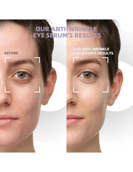 Suero para Ojos RWT con 5% Cafeína y Rodillo Masaje 360