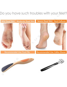 Lima de Pies Pumice Valley - Removedor de Callos 31 Cuchillas 2