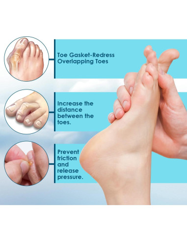 Separadores de Dedos de Espuma Kimihome - Alivio para Juanetes