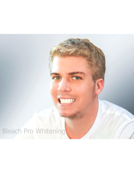 Gel Blanqueador Dental 22% Bleach Pro - 10 Jeringas de 3ml