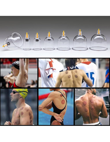 Kit de Ventosas Uplife 24 Copas para Masaje y Terapia