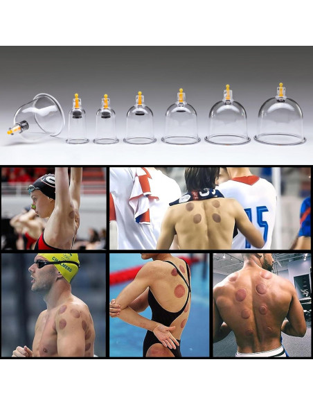 Kit de Ventosas Uplife 24 Copas para Masaje y Terapia