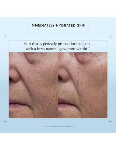 Crema Hidratante Philosophy Esperanza en un Frasco 59 ml - Ácido Hialurónico