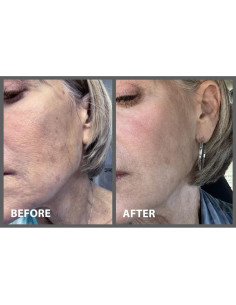 Suero Peptídico Antienvejecimiento Ice Elements con Bakuchiol 2