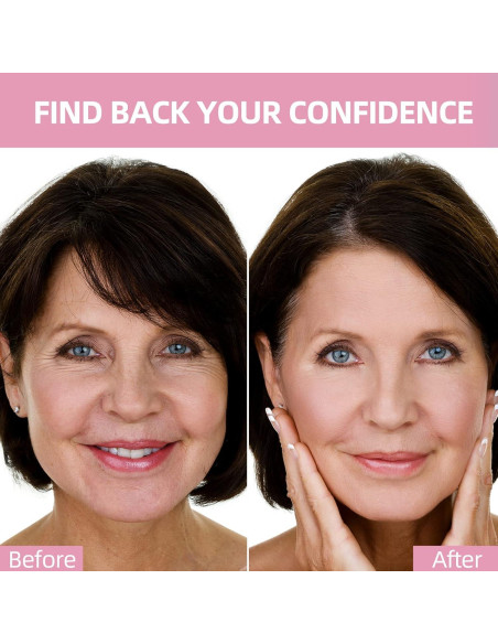 Parches Faciales Antienvejecimiento Rinycwa - 160 Pcs