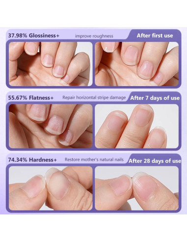 Lápiz de Cuidado de Uñas 3-en-1 Genérico con Aceite y Punta Cerámica