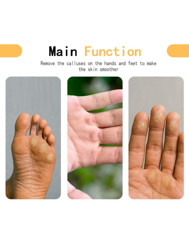 Removedor de Callos JLDGMXCDZ con 3 Papeles de Lija 100/180/400