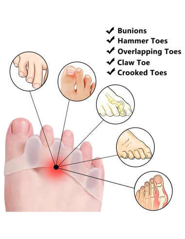 Separadores de Dedos de Silicona ZEYNOA - 6 Pcs Alivio Juanetes