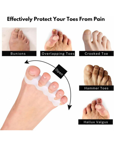 Separadores de Dedos de Silicona ZEYNOA - 6 Pcs Alivio Juanetes