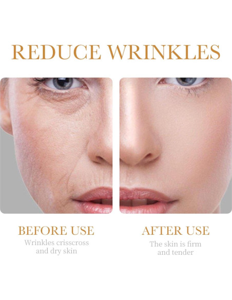 Juego de Cuidado Facial Antienvejecimiento Rosarden 6 Piezas