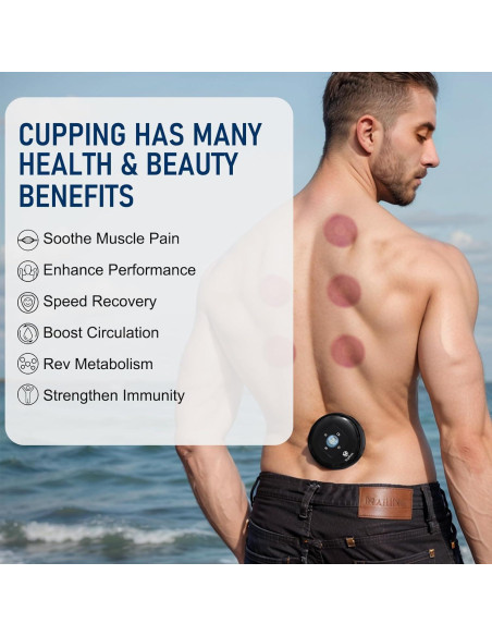 Set de Ventosas Inteligente 5-en-1 Yepfom con Calor y Luz Roja