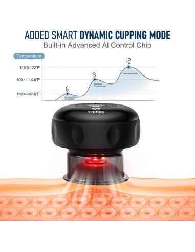 Set de Ventosas Inteligente 5-en-1 Yepfom con Calor y Luz Roja