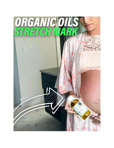 Aceite para Vientre Green + Lovely 236g Coco de Isla