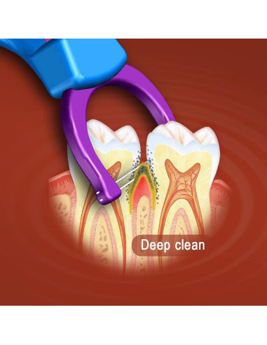 Hilo Dental Evolutivo T.Smile con 2 Mangos y 200 Recargas