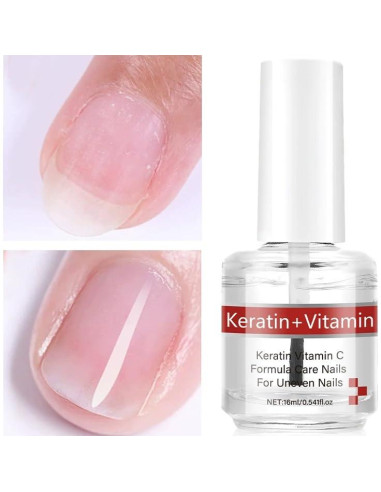 Aceite para Uñas y Cutículas Soelegant con Queratina y Vitaminas C