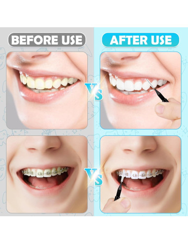 120 Cepillos Interdentales MAPVOLUT para Cuidado Oral Negro