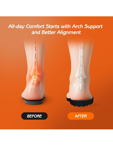 Plantillas Viscoelásticas Lennoos 4D para Mujeres - Soporte Arqueado