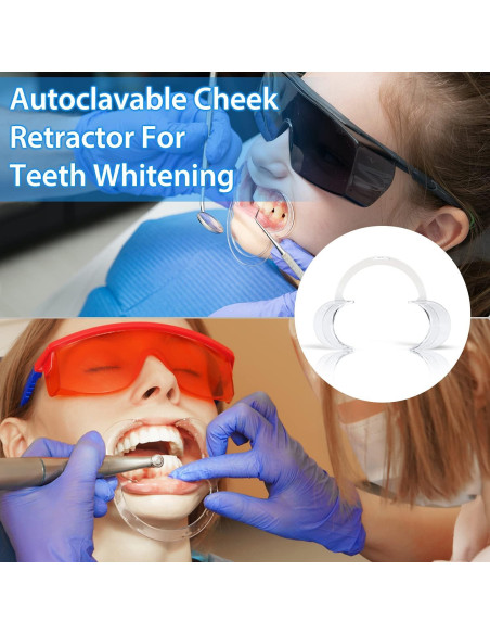 Retractor Bucal EZGO 20 Piezas Tamaño M para Blanqueamiento Dental