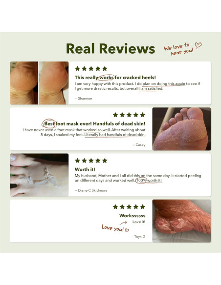 Mascarilla Exfoliante para Pies Purederm - 9 Unidades