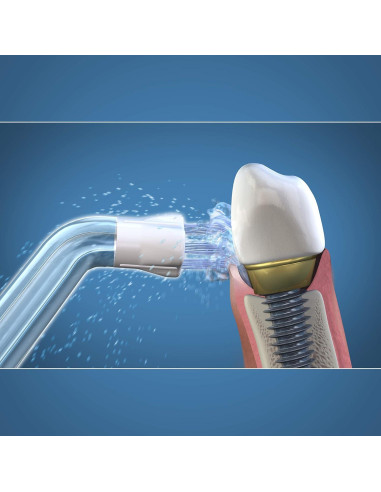 Consejos de Reemplazo Waterpik PS-100E para Irrigador Bucal - 2 Unidades