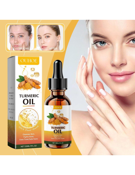 Aceite Facial de Cúrcuma Shantou 30ml - Piel Grasa y Acné