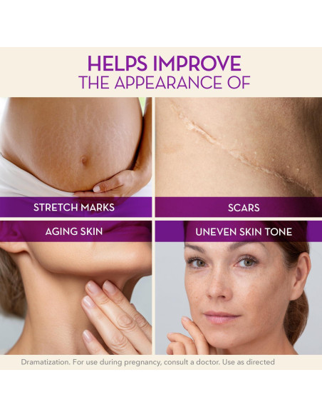 Cicatricure Cica Oil 198 ml - Aceite para Estrías y Cicatrices