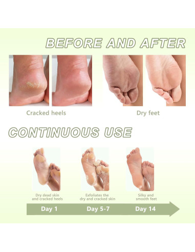 Mascarilla Exfoliante para Pies NAIAOHCR - 3 Pares Hidratantes