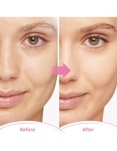 Juego de Máscaras de Hielo Reutilizables CONBELLA - Alivio Migrañas y Dolor