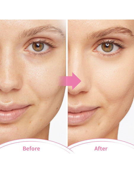 Juego de Máscaras de Hielo Reutilizables CONBELLA - Alivio Migrañas y Dolor