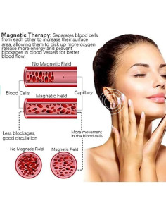 Pendientes de Aro de Drenaje Linfático Titanio Ion Lymphvity 2