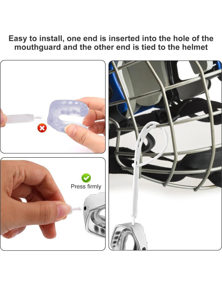 5 Correas de Reemplazo para Protector Bucal BOXOB 18.1 cm Blanco