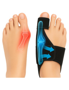 Corrector de Juanetes Benoo - Alivio y Alineación de Dedos