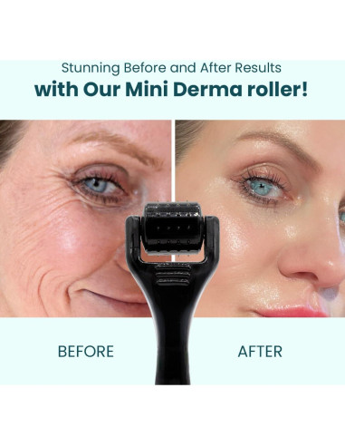 Mini Rodillo Derma Gin Amber 0.25mm - 48 Agujas para Piel