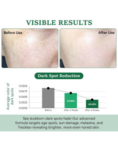 Removedor de Manchas Oscuras Aurivoy 19.8 ml con Rodillo 360 2