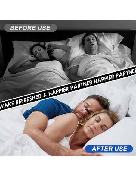 60 Tiras Nasales Hantskop para Ronquidos - Alivio Nocturno