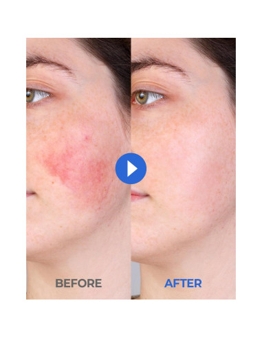 CCP Crema Coreana Hidratante 50 ml Alivio Picazón Piel Seca