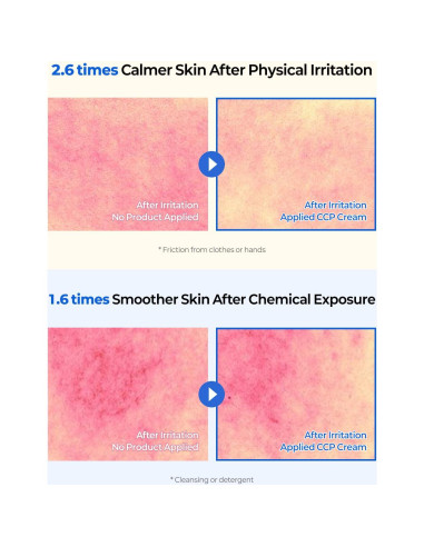 CCP Crema Coreana Hidratante 50 ml Alivio Picazón Piel Seca