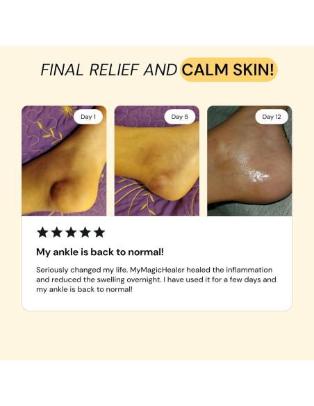 MyMagicHealer Ungüento Alivio Dolor Muscular 56.7g