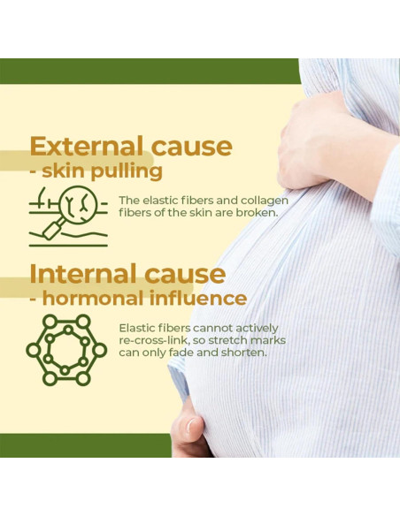 Aceite Corporal Hidratante Eelhoe 150ml - Oliva Orgánico con Vitamina E