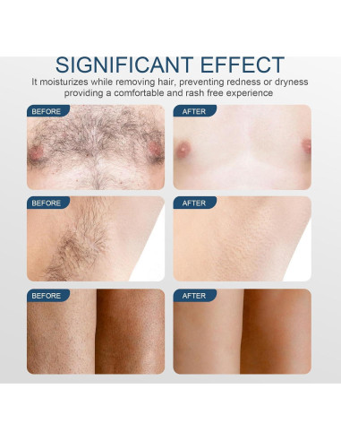 Crema Depilatoria para Hombres 124ml - Indolora para Cuerpo y Áreas Íntimas