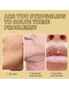 Bálsamo Hidratante de Grasa de Res Ailutle 160g con Miel 2