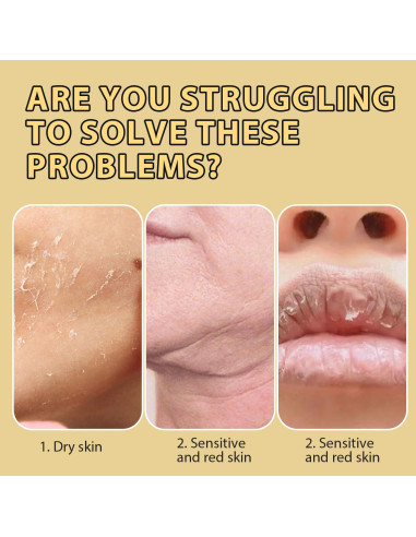 Bálsamo Hidratante de Grasa de Res Ailutle 160g con Miel