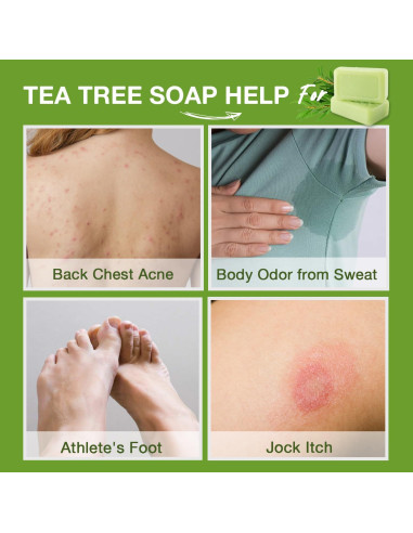 Barra de Jabón Antifúngico PHARMBANNER 2x116g - Acné, Eczema