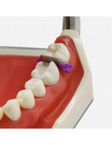 30 Piezas Protector Interproximal Dental Prime con Cuchillo