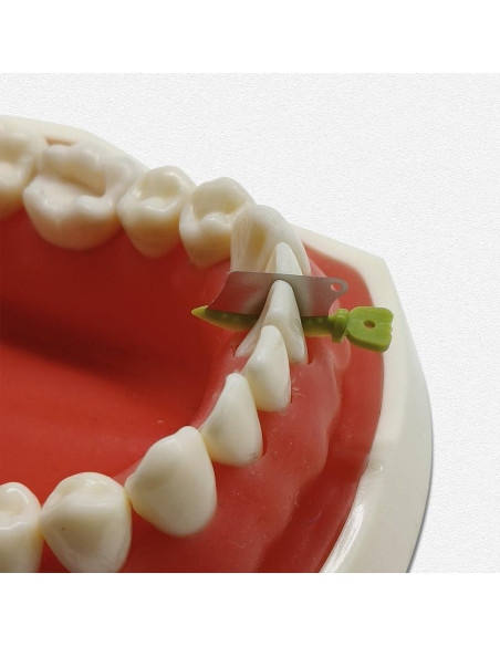 30 Piezas Protector Interproximal Dental Prime con Cuchillo