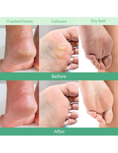 Mascarilla Exfoliante para Pies Plantifique 4 Paquetes Hombres y Mujeres