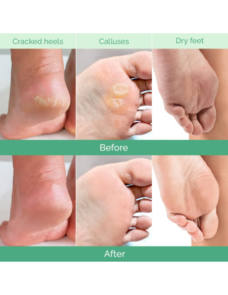 Mascarilla Exfoliante para Pies Plantifique 4 Paquetes Hombres y Mujeres