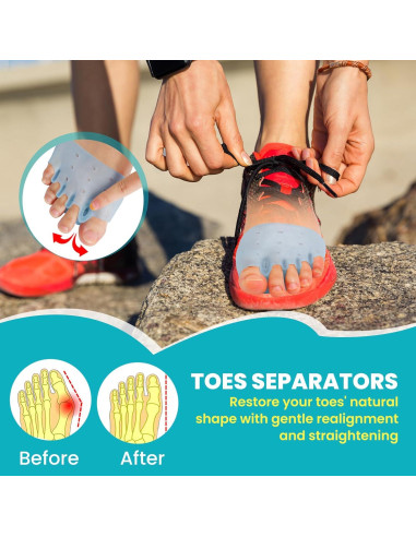 Separadores de Dedos y Almohadillas Metatarsales TASZOOS - 4 PCS