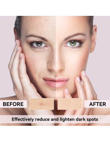 Removedor de Manchas Oscuras DMYGO 50 ml con Vitamina C